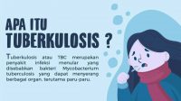 Tuberculosis Dapat Menyerang Siapa Saja,Kenali Gejalanya