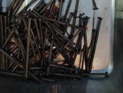 Dokter Bedah Keluarkan Puluhan Paku dari Perut Pria Asal Indramayu