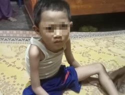 Tak tersentuh Bansos dan Program MBG,Bocah di Natar Lampung Terkena Gizi Buruk